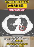 杭州姑娘清理发霉衣柜导致肺部长霉菌